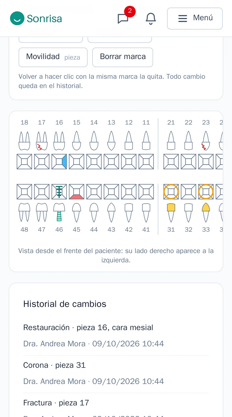 Odontograma de un paciente con caries, restauraciones, corona, implante, fractura y extracción indicada